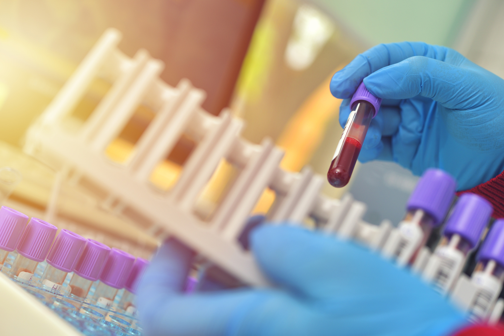 Tubos con muestras para análisis de laboratorio
